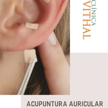 Acupuntura Auricular em Curuça