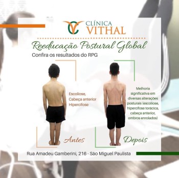 Clinica de Reeducação Postural Global em Curuça